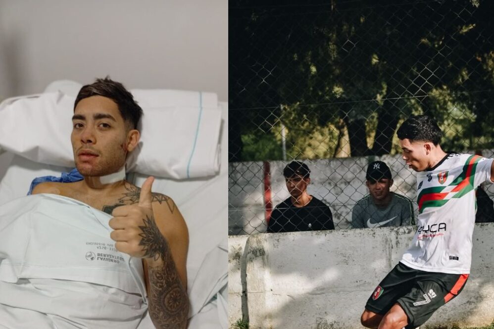 Imagen 1: el día después de la golpiza en Alejandro Korn. Imagen 2: cicatriz de la segunda operación.