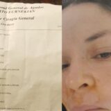 Valeria Valdez, de San Vicente, necesita juntar entre 8 y 10 millones de pesos para pagar una prótesis facial.