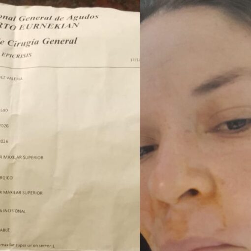 Valeria Valdez, de San Vicente, necesita juntar entre 8 y 10 millones de pesos para pagar una prótesis facial.