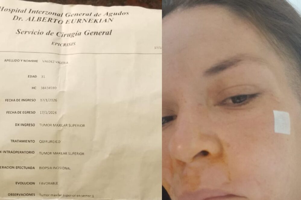 Valeria Valdez, de San Vicente, necesita juntar entre 8 y 10 millones de pesos para pagar una prótesis facial.