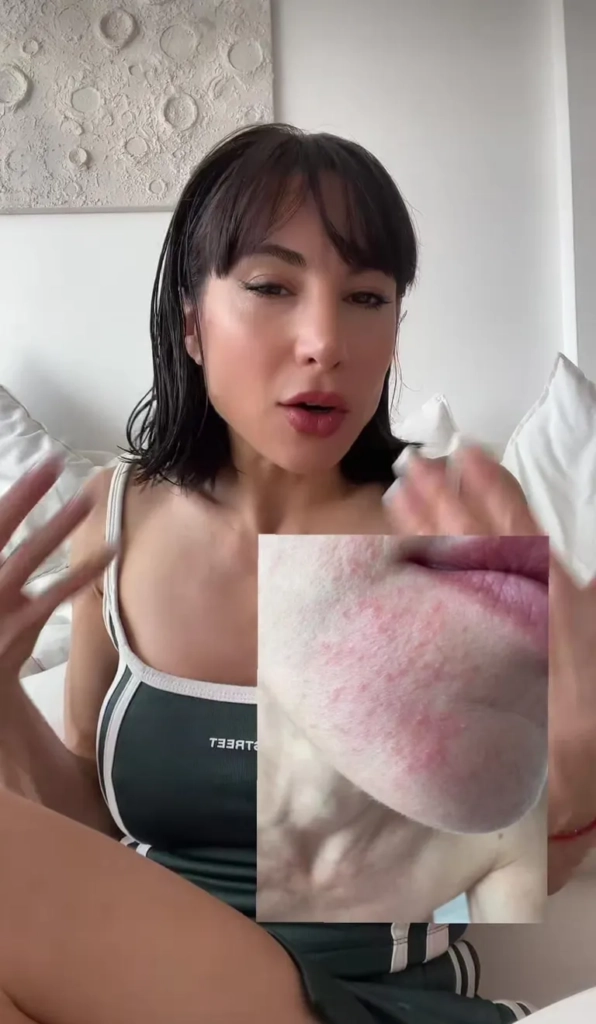 Ex figura de Bailando, 38, madre primeriza y separada tras 15 años, sufre lesión facial 2 Ex figura de Bailando, 38, madre primeriza y separada tras 15 años, sufre lesión facial