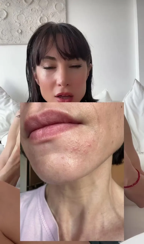 Ex figura de Bailando, 38, madre primeriza y separada tras 15 años, sufre lesión facial 3 Ex figura de Bailando, 38, madre primeriza y separada tras 15 años, sufre lesión facial